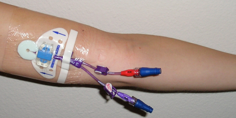 Peripheral Intravenous Catheter