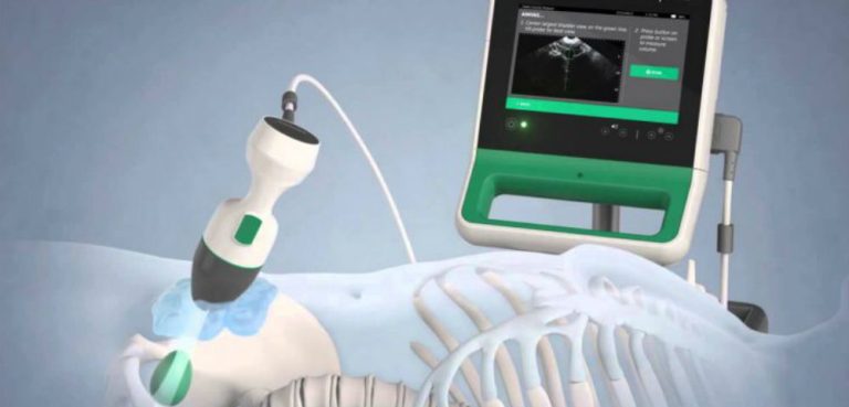 Portable Ultrasound Bladder Scanner