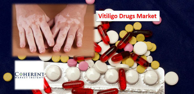 Vitiligo Drugs 2